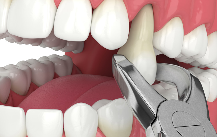 Treatment - King Cross Dental