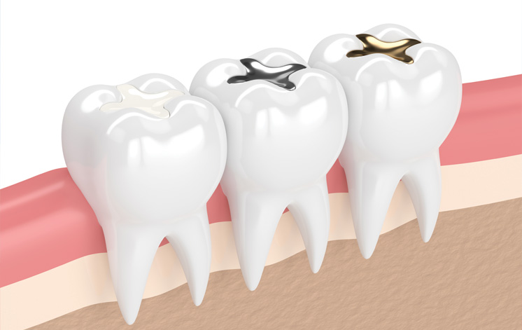 Treatment - King Cross Dental